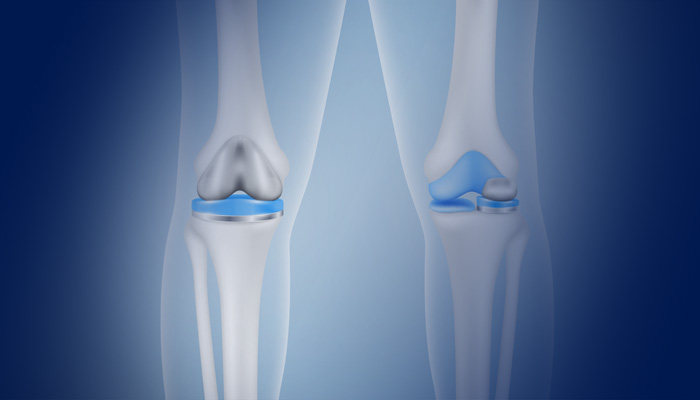 chirurgia-ginocchio-5