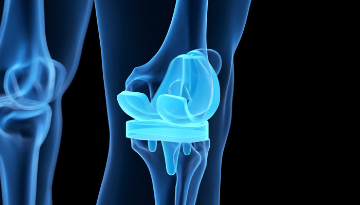 chirurgia-ginocchio-6